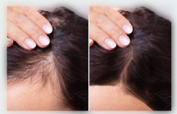 Woman showing hair growth after using nertias natural hair growth oil